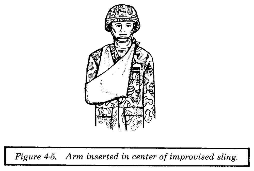 Drawing of a soldier with an injured arm resting in a cloth sling tied behind the neck
